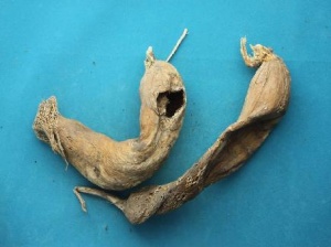 地骷髅:点击看原图 地骷髅