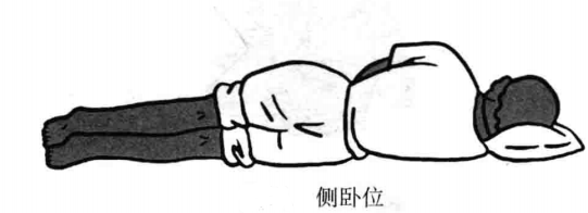 侧卧位