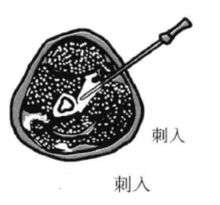 刺入