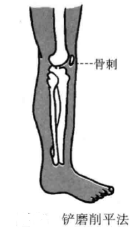 铲磨削平法