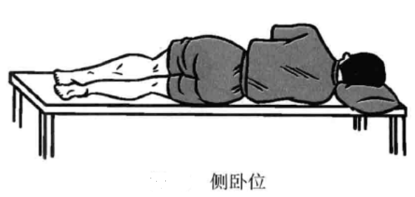侧卧位