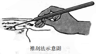 推刮法