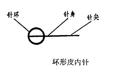 环形皮内针