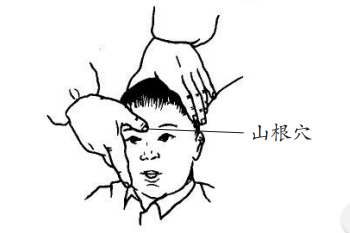 山根穴