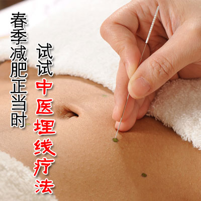 春季减肥正当时 试试中医埋线疗法